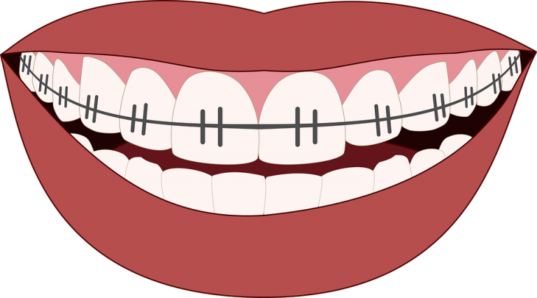 Sustain Your Enhancing Smile by Gaining Orthodonture
