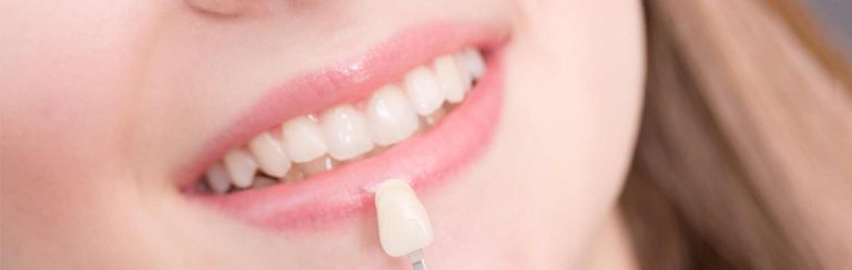 Understand the significance of beautiful smile by porcelain veneers Melbourne Professional