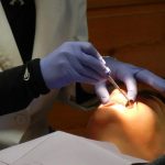 orthodontic procedure