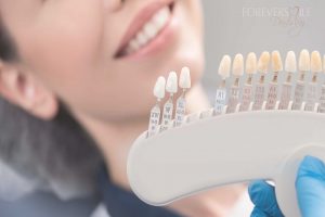 Everything You Should Know Before Getting Porcelain Veneers