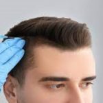 Hair Transplant cure baldness