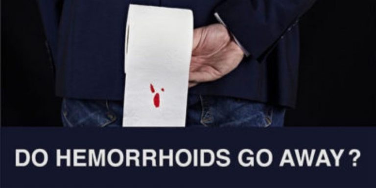 Do Hemorrhoids Going Away?