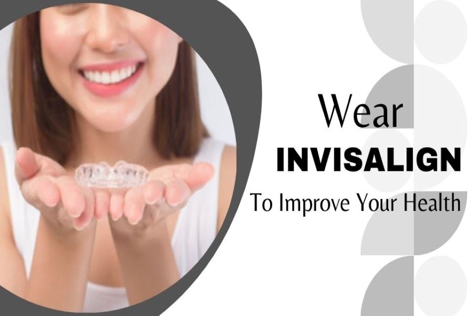 invisalign wimbledon