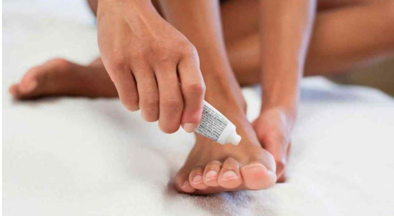 nail fungal infection cream India