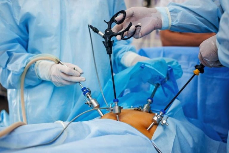 5 Advantages Of Laparoscopic Surgery