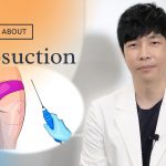 liposuction neck surgery