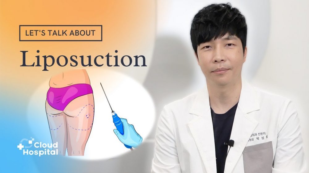 liposuction neck surgery
