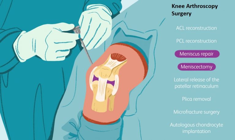 ARTHROSCOPIC SURGERY- THE WAY FORWARD TO KNEE, HIP & SHOULDER PAIN