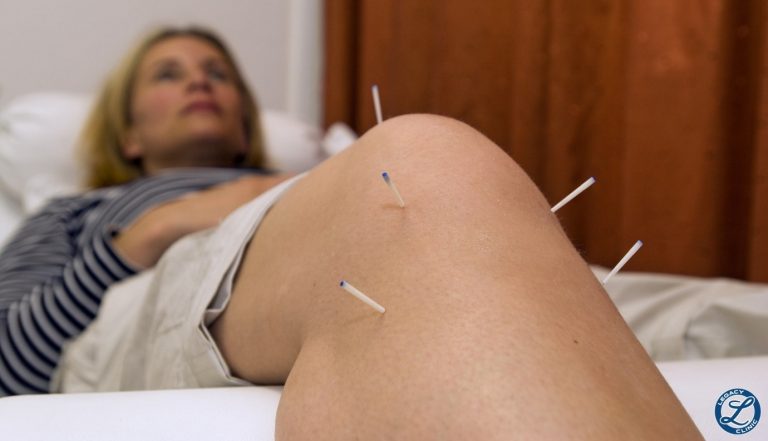 Acupuncture in The Villages – What Issues Can Acupuncture Help With?