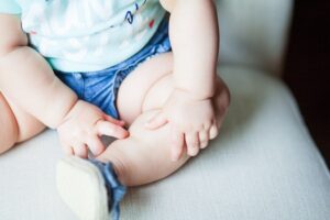 6 Skin Conditions in Babies Parents Should be Aware of