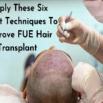 fue hair transplant