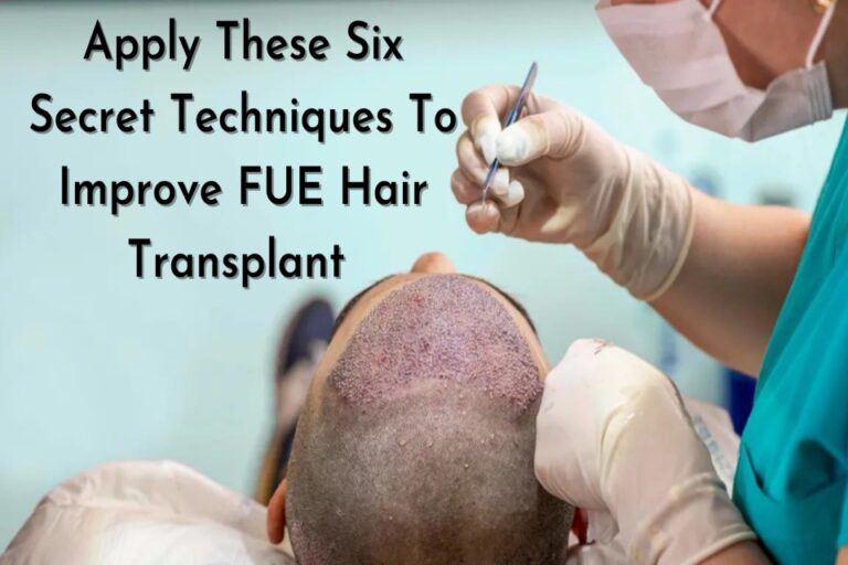 Apply These Six Secret Techniques To Improve FUE Hair Transplant