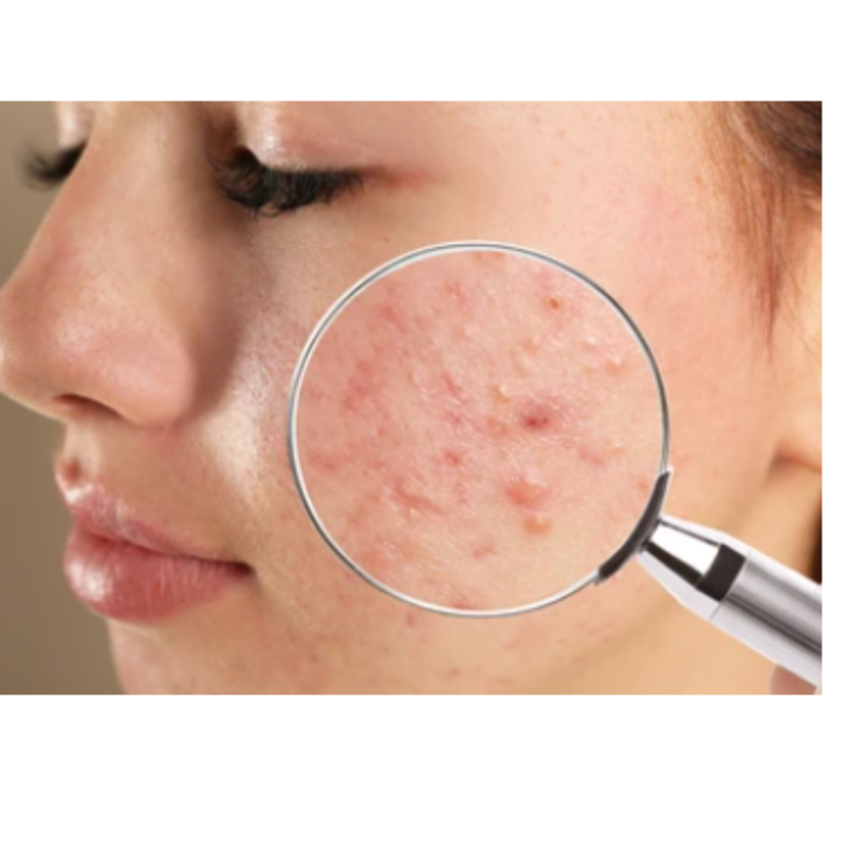 Things to Consider When Choosing the Right Dermatologist in Bangalore