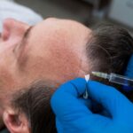 non-surgical-hair-transplant