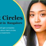 dark circles treatment