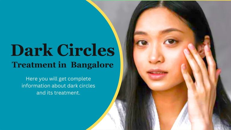 Medical Treatments for Dark Circles