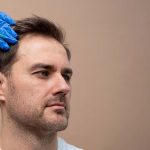 hair transplant rate