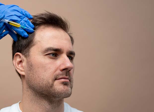 A Guide to Hair Transplant Success Rate 