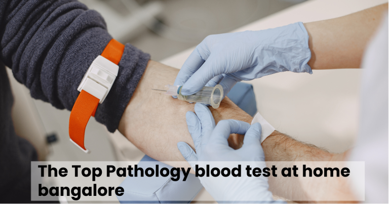 The Top Pathology blood test at home bangalore