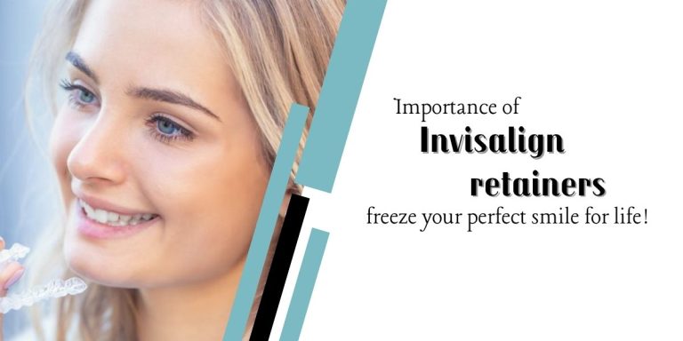 Importance of Invisalign retainers – freeze your perfect smile for life!