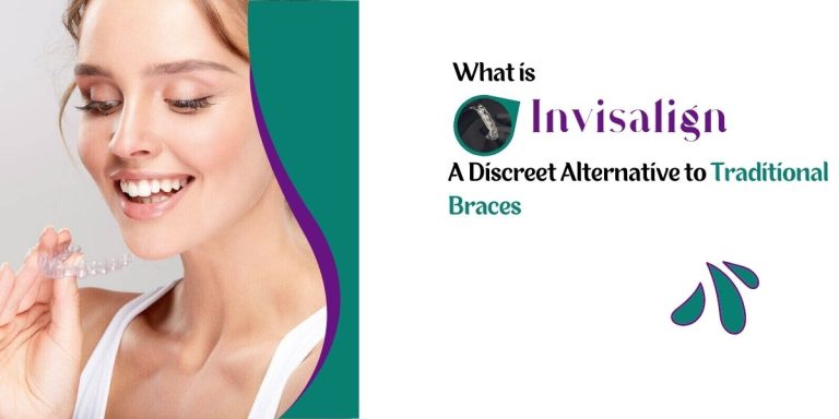 What is Invisalign: A Discreet Alternative to Traditional Braces