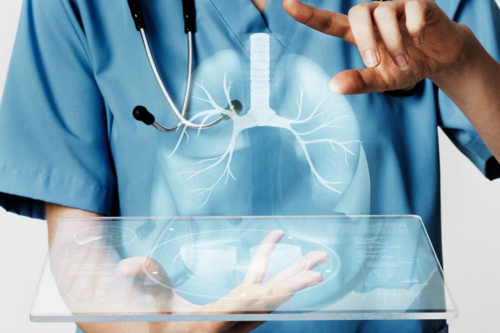 lung cancer treatment