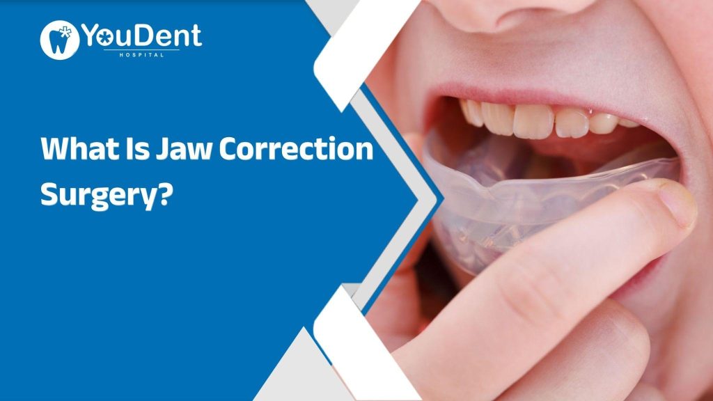 jaw correction surgery