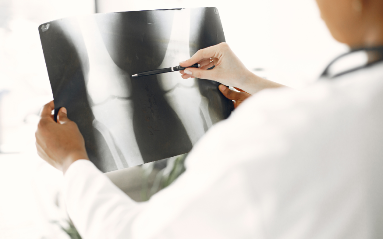 What Your Orthopedist Really Does: Beyond Broken Bones