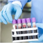 any lab test now mesquite tx