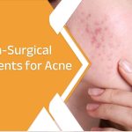 best acne scar treatment in jaipur