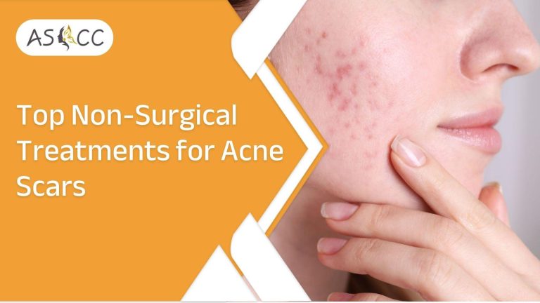 Top Non-Surgical Treatments for Acne Scars