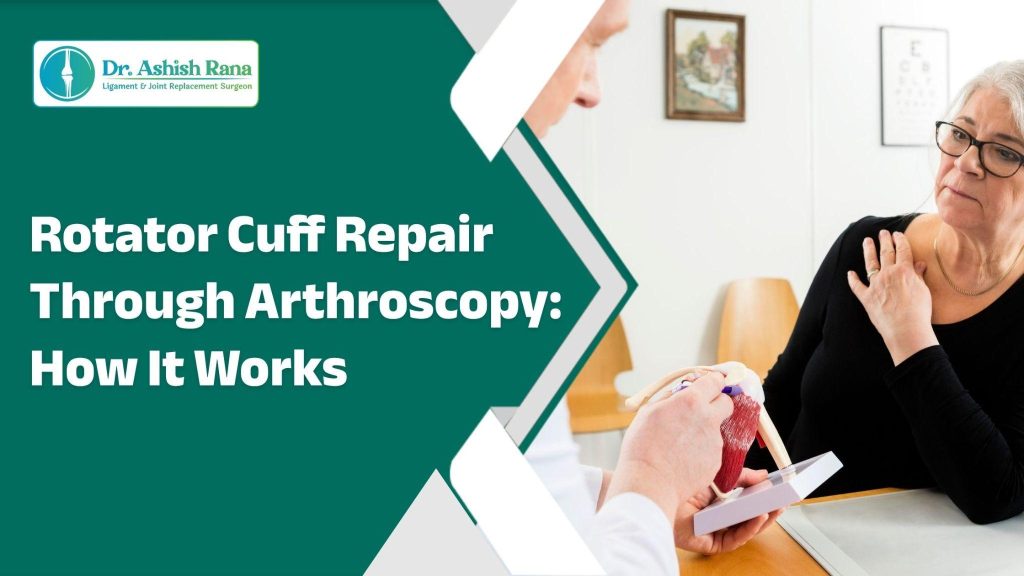 rotator cuff repair