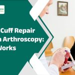 rotator cuff repair