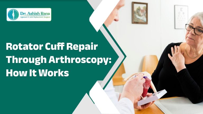 Rotator Cuff Repair Through Arthroscopy: How It Works