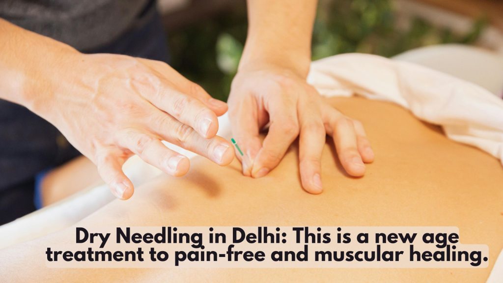 dry needling in delhi