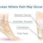 foot arch support for flat feet