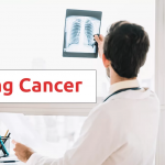 lung cancer treatment