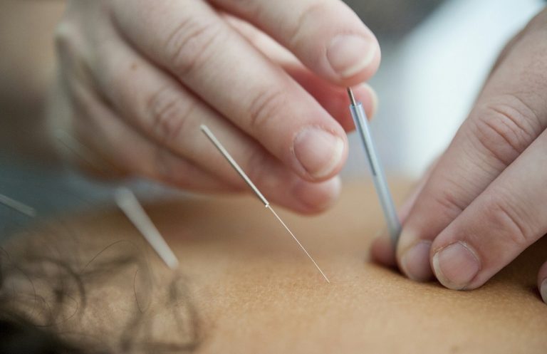 When Should​ You Visit an Acupuncture Clinic in Port Moody​?
