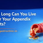 appendix bursts
