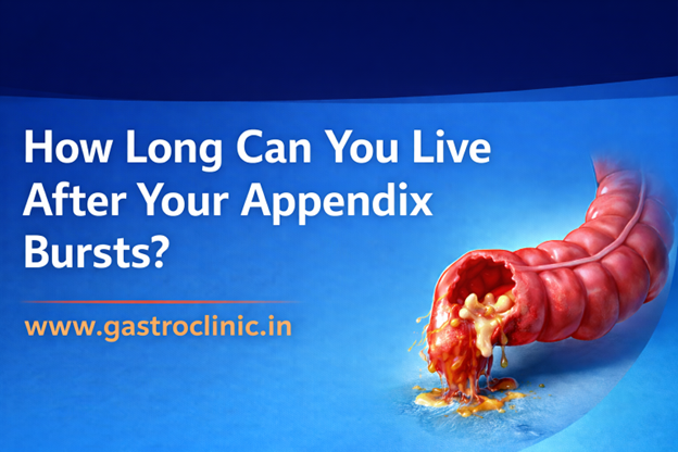 appendix bursts