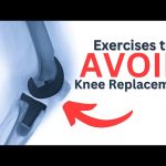 knee replacement surgery