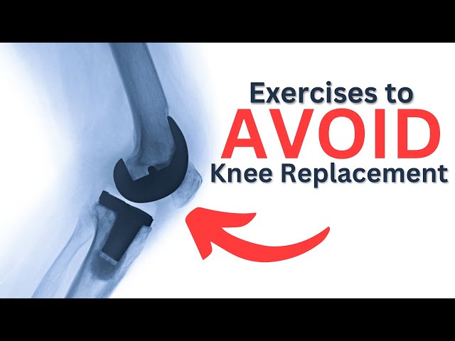 How to Avoid Knee Replacement Surgery?