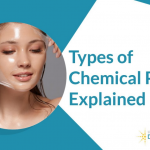 chemical peels