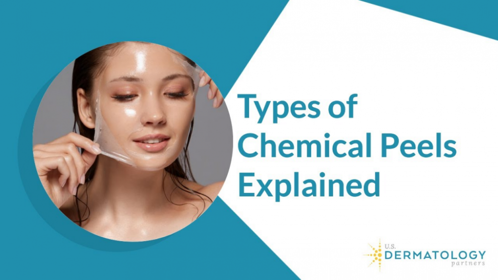 chemical peels