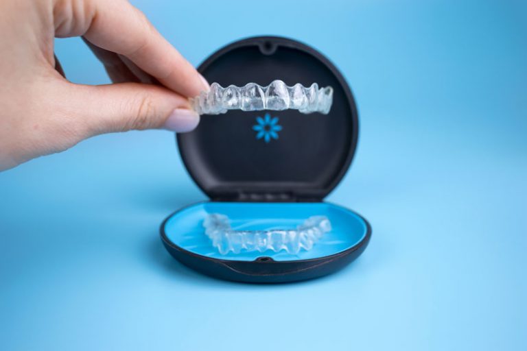 Invisalign In Adyar: Is It Worth The Cost Over Traditional Braces In Chennai?
