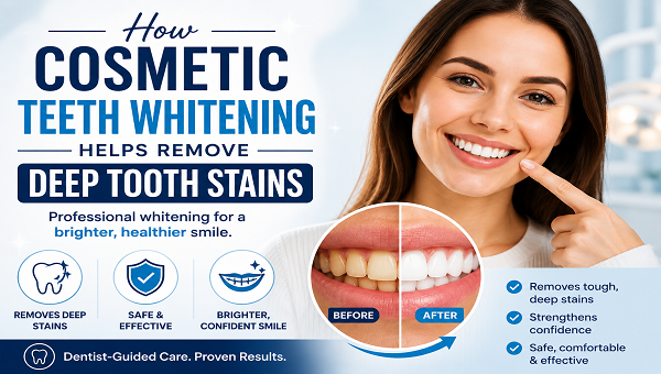 How Cosmetic Teeth Whitening Helps Remove Deep Tooth Stains