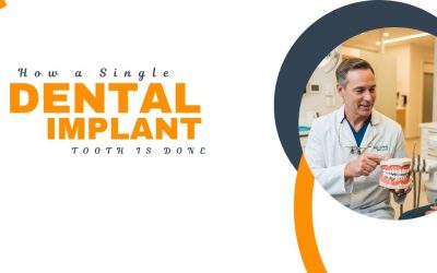 single dental implant