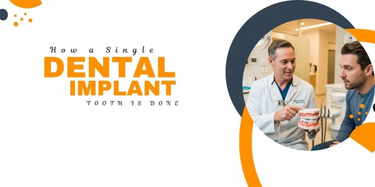 How a Single Dental Implant Tooth is done